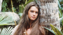 Actrice Brooke Shields over ongewenste operatie: 